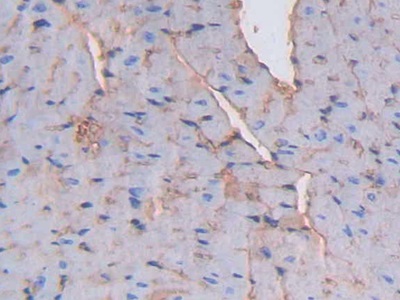 Polyclonal Antibody to Albumin (ALB)