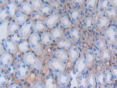 Polyclonal Antibody to Albumin (ALB)