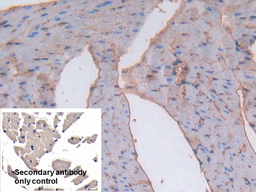 Polyclonal Antibody to Albumin (ALB)