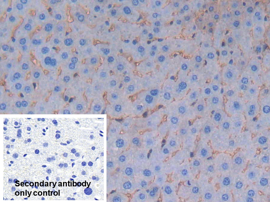 Polyclonal Antibody to Albumin (ALB)