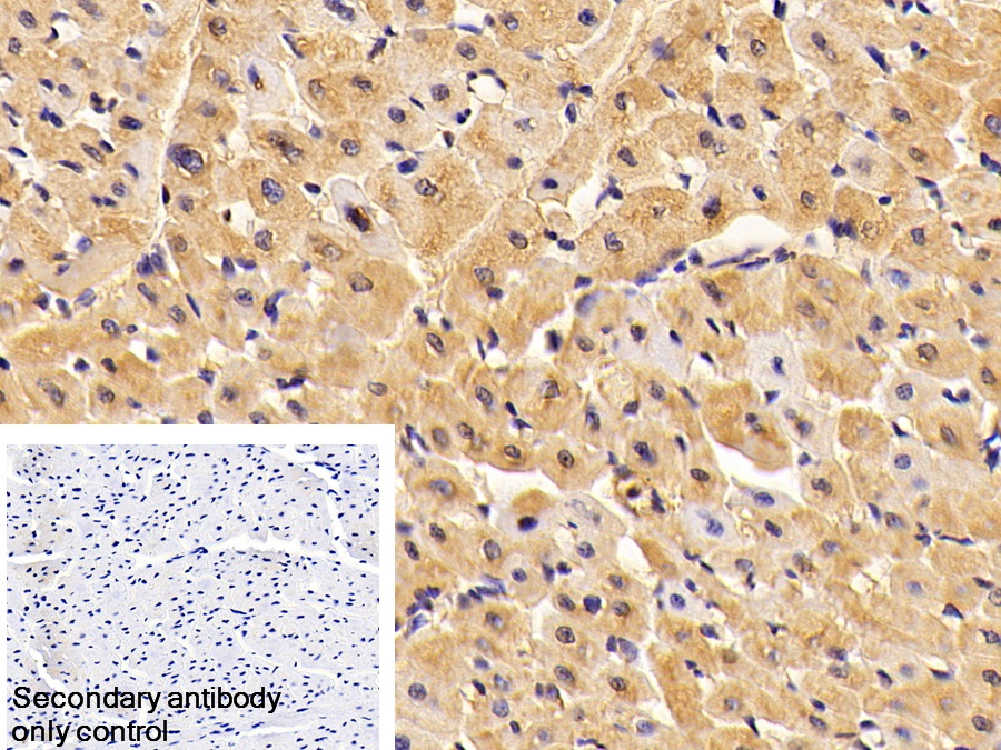 Polyclonal Antibody to Albumin (ALB)