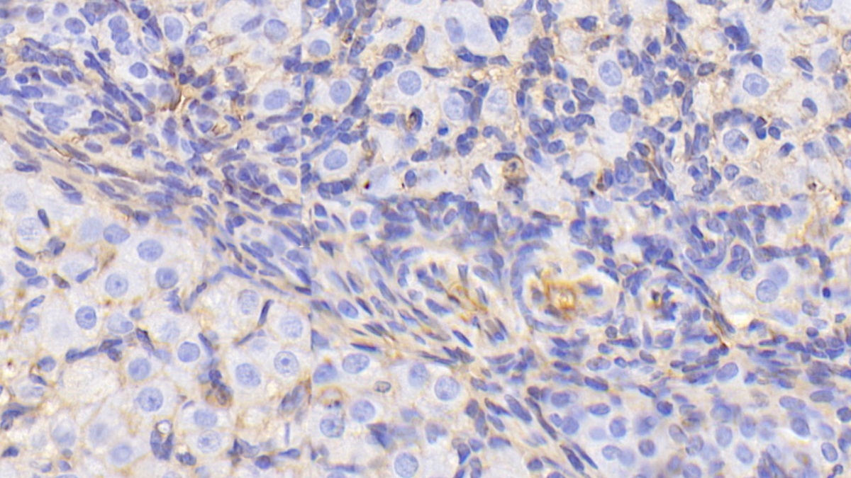 Polyclonal Antibody to Albumin (ALB)