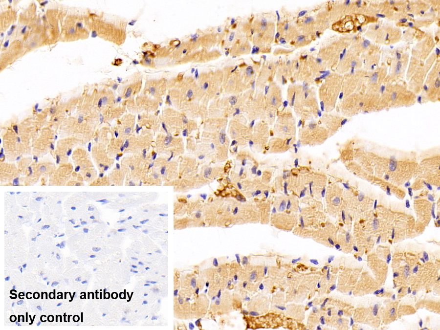 Polyclonal Antibody to Albumin (ALB)