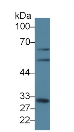 Polyclonal Antibody to Glutamate Cysteine Ligase, Modifier Subunit (GCLM)