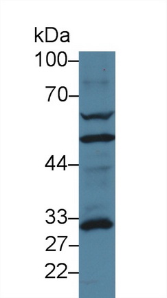 Polyclonal Antibody to Glutamate Cysteine Ligase, Modifier Subunit (GCLM)