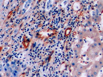 Polyclonal Antibody to Vimentin (VIM)