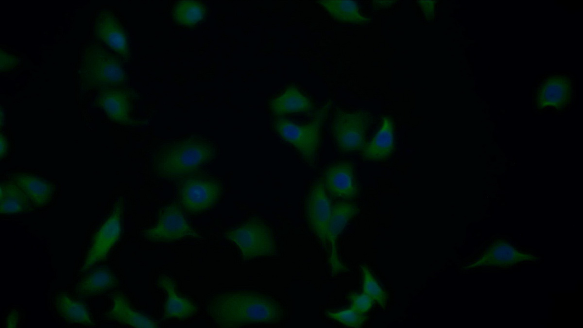 Polyclonal Antibody to Apoptotic Peptidase Activating Factor 1 (APAF1)