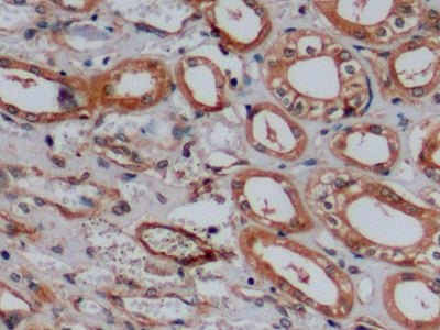 Polyclonal Antibody to Cluster Of Differentiation 15 (CD15)