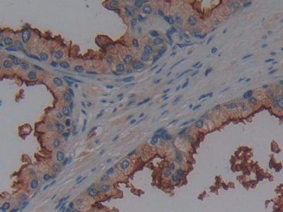 Polyclonal Antibody to Alanine Aminopeptidase (AAP)