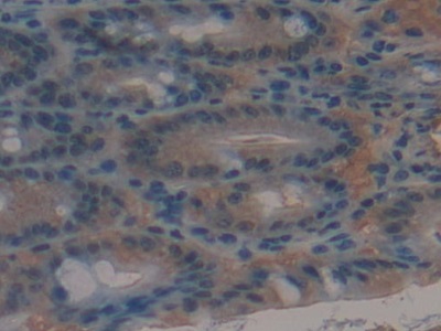 Polyclonal Antibody to Multidrug Resistance Associated Protein 1 (MRP1)