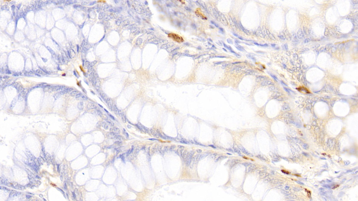 Polyclonal Antibody to Tryptase (TPS)