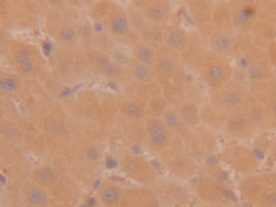 Polyclonal Antibody to Tryptase (TPS)