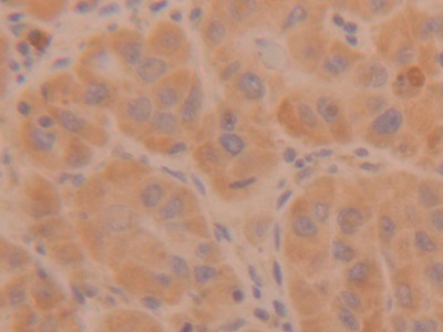 Polyclonal Antibody to Tryptase (TPS)