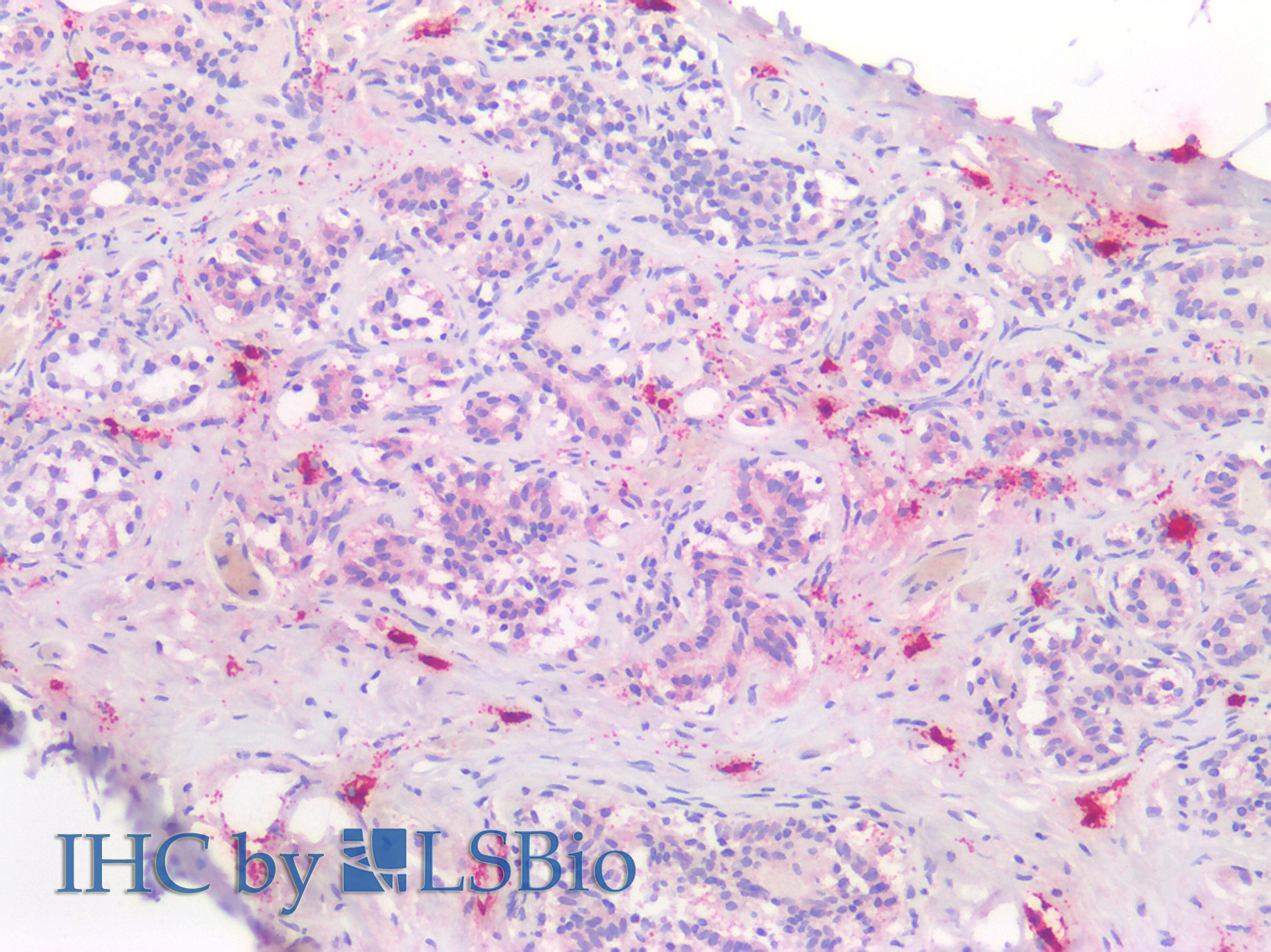 Polyclonal Antibody to Tryptase (TPS)