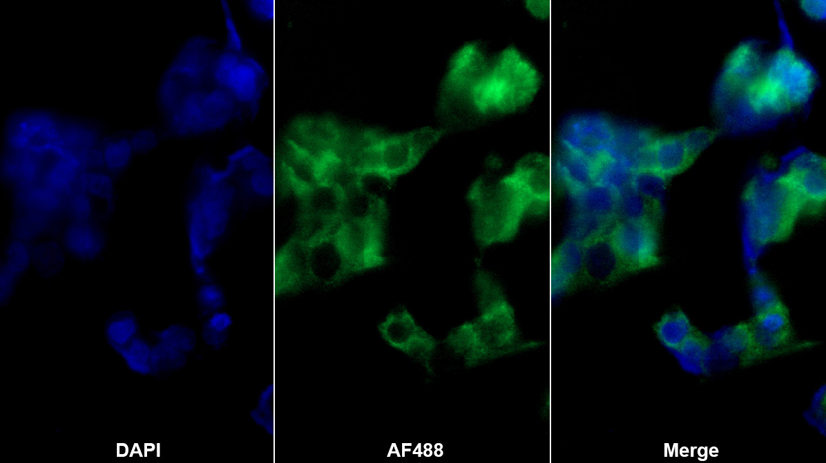 Polyclonal Antibody to Tryptase (TPS)