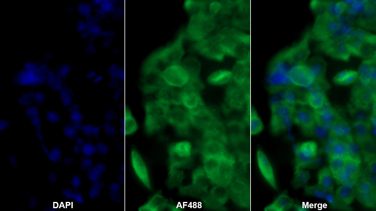 Polyclonal Antibody to Tryptase (TPS)