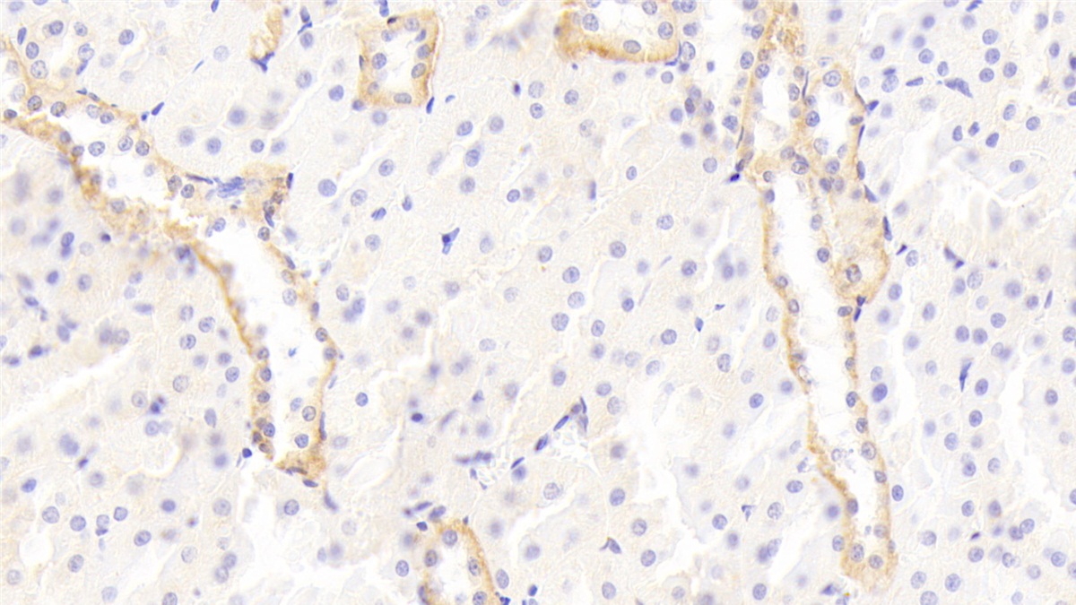 Polyclonal Antibody to Polymeric Immunoglobulin Receptor (PIGR)