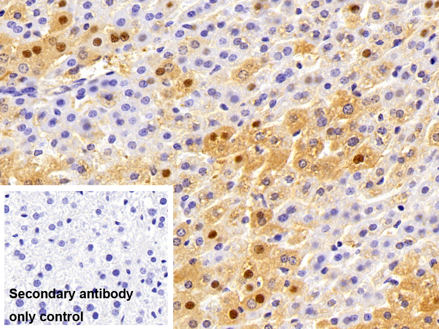 Polyclonal Antibody to General Transcription Factor IIH Subunit 1 (GTF2H1)