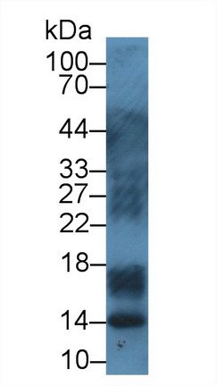 Polyclonal Antibody to S100 Calcium Binding Protein A12 (S100A12)