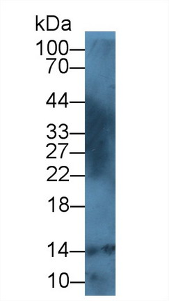 Polyclonal Antibody to S100 Calcium Binding Protein A12 (S100A12)