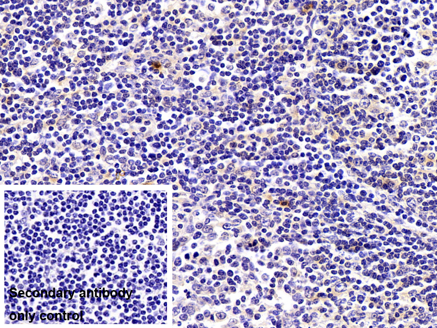 Polyclonal Antibody to S100 Calcium Binding Protein A12 (S100A12)