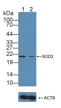 Polyclonal Antibody to Superoxide Dismutase 2, Mitochondrial (SOD2)