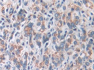 Polyclonal Antibody to Superoxide Dismutase 2, Mitochondrial (SOD2)