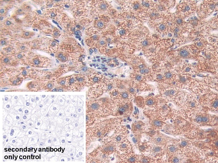 Polyclonal Antibody to Superoxide Dismutase 2, Mitochondrial (SOD2)