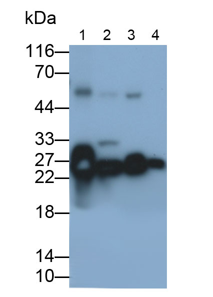 Polyclonal Antibody to Superoxide Dismutase 2, Mitochondrial (SOD2)