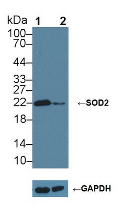 Polyclonal Antibody to Superoxide Dismutase 2, Mitochondrial (SOD2)