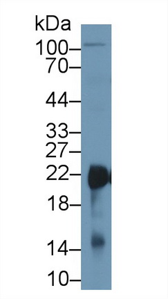 Polyclonal Antibody to Superoxide Dismutase 2, Mitochondrial (SOD2)