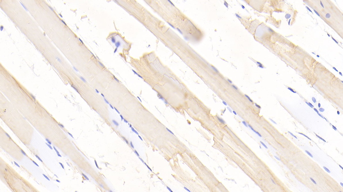 Polyclonal Antibody to Superoxide Dismutase 2, Mitochondrial (SOD2)