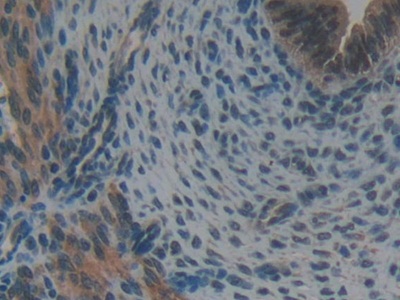 Polyclonal Antibody to Glutathione S Transferase Kappa 1 (GSTk1)