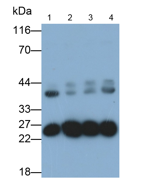 Polyclonal Antibody to Glutathione S Transferase Pi (GSTp)