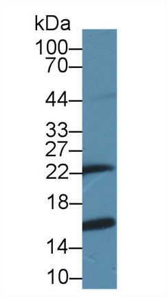 Polyclonal Antibody to Glutathione S Transferase Pi (GSTp)