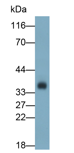 Polyclonal Antibody to Cluster Of Differentiation 8a (CD8a)