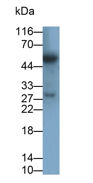 Polyclonal Antibody to Cluster Of Differentiation 8a (CD8a)