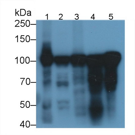 Polyclonal Antibody to Actinin Alpha 3 (ACTN3)