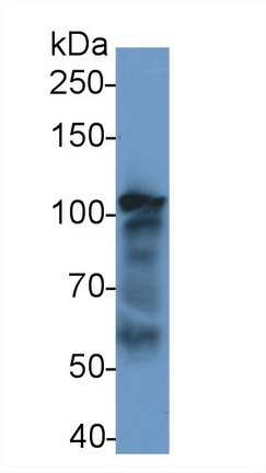 Polyclonal Antibody to Nucleoporin 107kDa (NUP107)