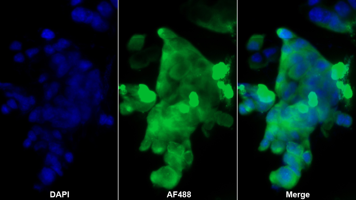 Polyclonal Antibody to Metallothionein 1 (MT1)