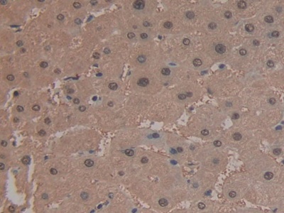 Polyclonal Antibody to Arginase (ARG)