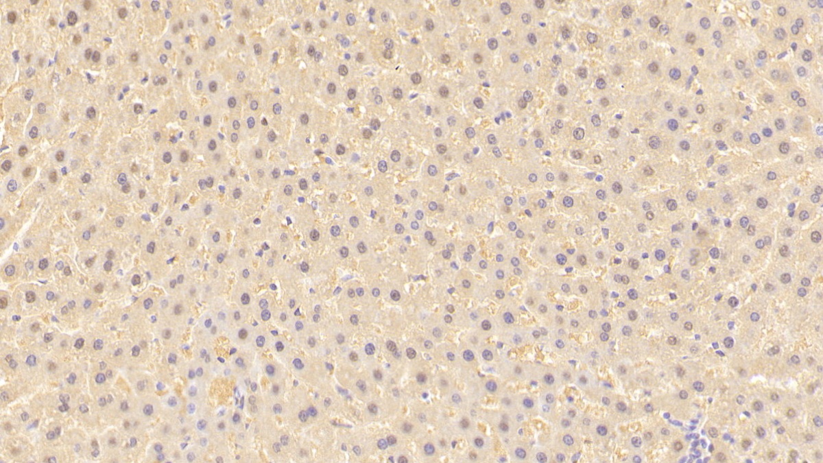 Polyclonal Antibody to Arginase (ARG)