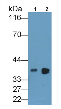 Polyclonal Antibody to Arginase (ARG)