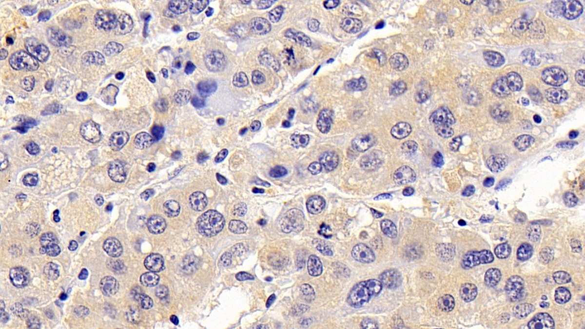 Polyclonal Antibody to Chemokine C-C-Motif Ligand 16 (CCL16)