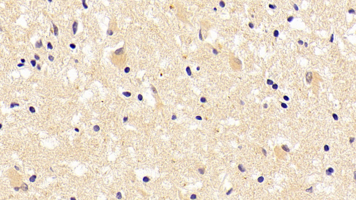 Polyclonal Antibody to Chemokine C-C-Motif Ligand 16 (CCL16)