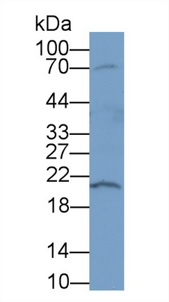 Polyclonal Antibody to Deoxyribonuclease I (DNASE1)