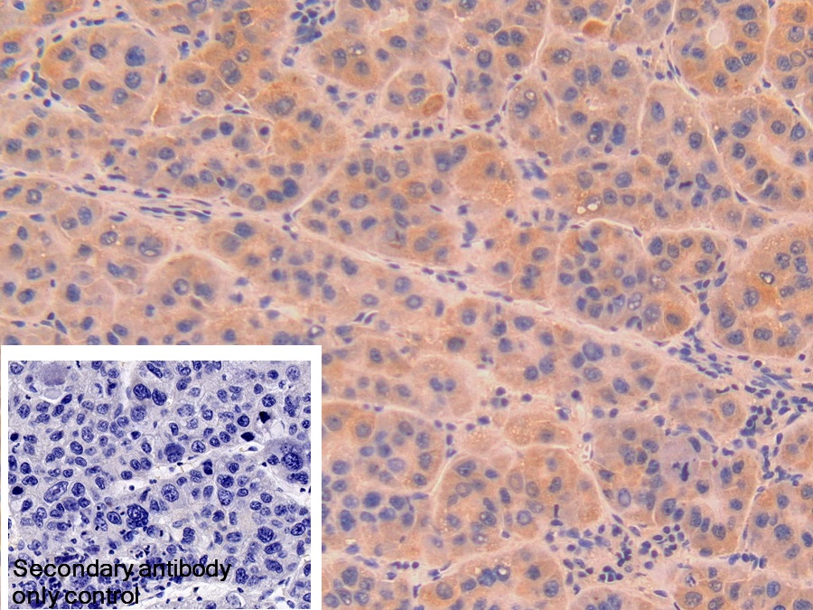 Polyclonal Antibody to Deoxyribonuclease I (DNASE1)