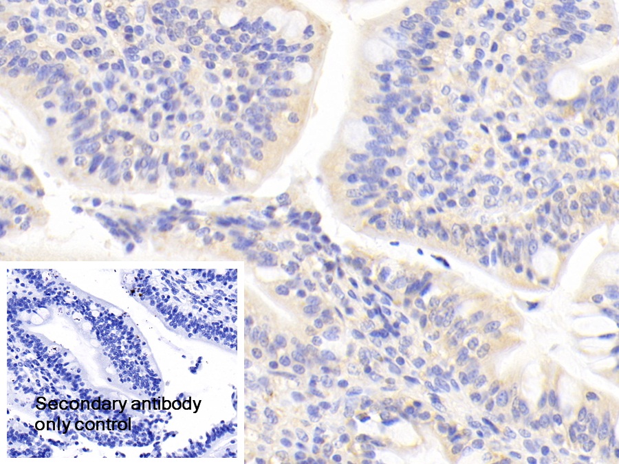 Polyclonal Antibody to c-Jun N-terminal Kinase 1 (JNK1)