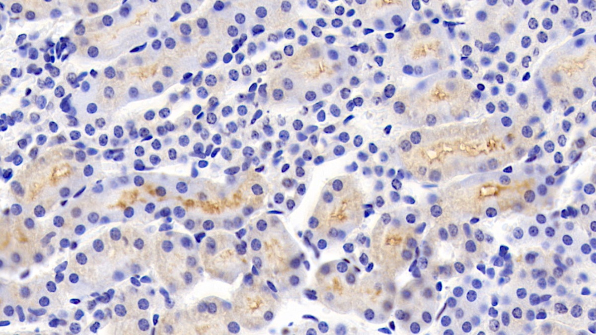 Polyclonal Antibody to c-Jun N-terminal Kinase 1 (JNK1)