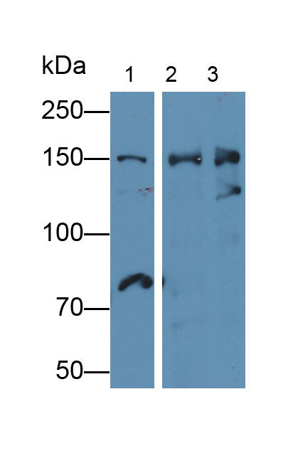 Polyclonal Antibody to Nucleoporin 155 (NUP155)